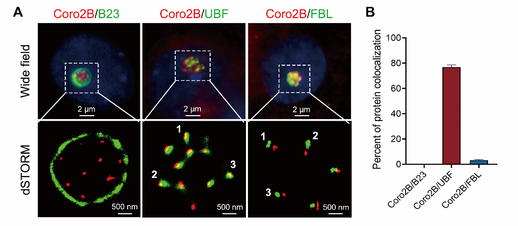 Cell Death & Disease丨深圳先进院陈宇/陈岳文团队发现神经核仁应激发生机制
